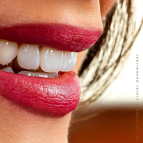 Do you see the veneers? 😌 Do you see the veneers? 😌