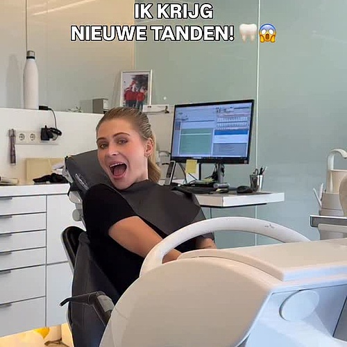 Van composiet facings op mijn 19e… naar eindelijk beginnen aan mijn droomsmile met No Prep Veneers 😭🦷 Ik neem jullie... Van composiet facings op mijn 19e… naar eindelijk beginnen aan mijn droomsmile met No Prep Veneers 😭🦷 Ik neem jullie...